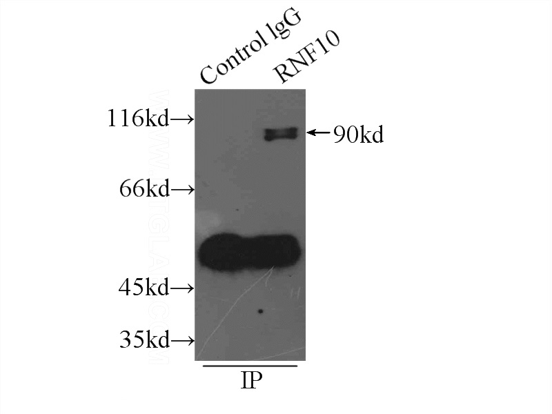 IP Result of anti-RNF10 (IP:Catalog No:114735, 5ug; Detection:Catalog No:114735 1:500) with PC-3 cells lysate 2200ug.