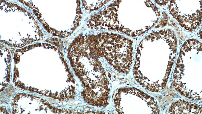 Immunohistochemical of paraffin-embedded human testis using Catalog No:111577(HYAL3 antibody) at dilution of 1:50 (under 10x lens)