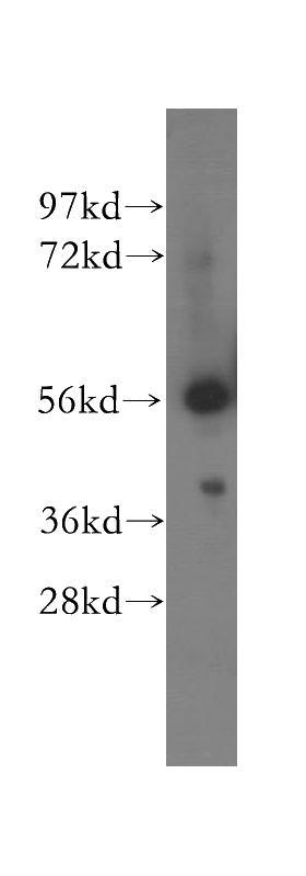 human brain tissue were subjected to SDS PAGE followed by western blot with Catalog No:113524(SCOT antibody) at dilution of 1:400