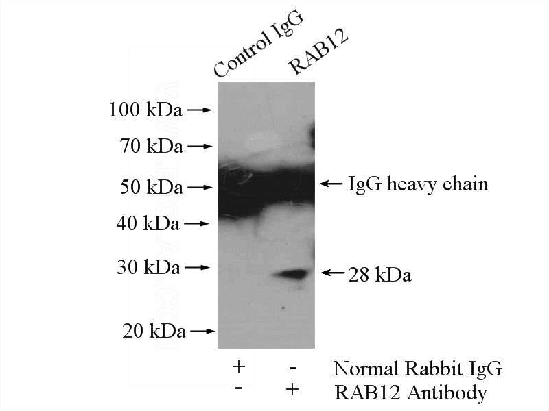 IP Result of anti-RAB12 (IP:Catalog No:114412, 4ug; Detection:Catalog No:114412 1:500) with HeLa cells lysate 1200ug.