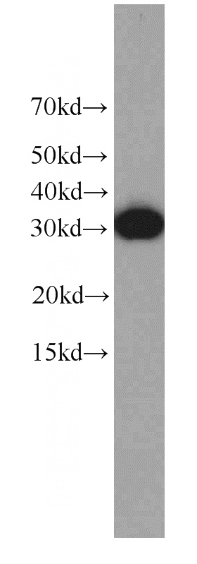 Jurkat cells were subjected to SDS PAGE followed by western blot with Catalog No:107196(EXOSC2 antibody) at dilution of 1:1000