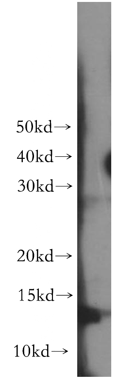 human heart tissue were subjected to SDS PAGE followed by western blot with Catalog No:114533(RAMP1 antibody) at dilution of 1:300