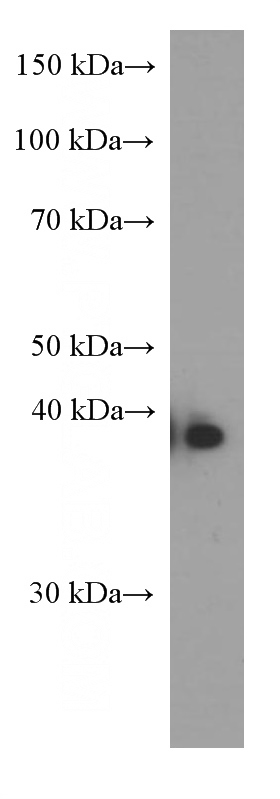 A431 cells were subjected to SDS PAGE followed by western blot with Catalog No:107193(ERCC1 Antibody) at dilution of 1:2000