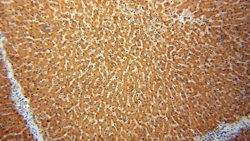 Immunohistochemical of paraffin-embedded human liver using Catalog No:115362(SLC27A2 antibody) at dilution of 1:50 (under 10x lens)