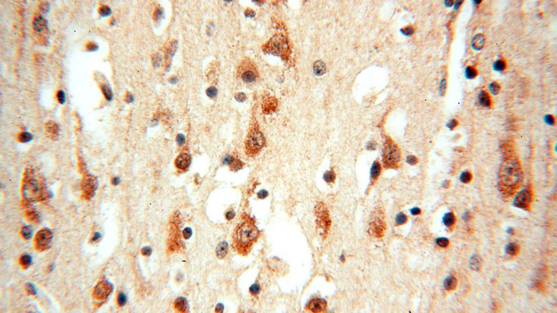 Immunohistochemical of paraffin-embedded human brain using Catalog No:116352(TRBP antibody) at dilution of 1:100 (under 40x lens)