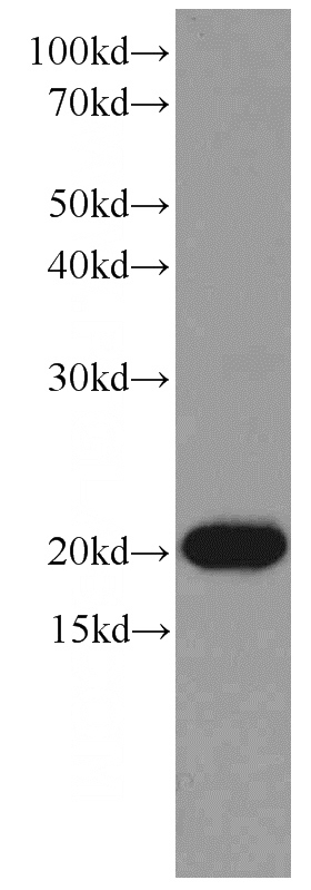 HL-60 cells were subjected to SDS PAGE followed by western blot with Catalog No:107494(RAC1 antibody) at dilution of 1:1000