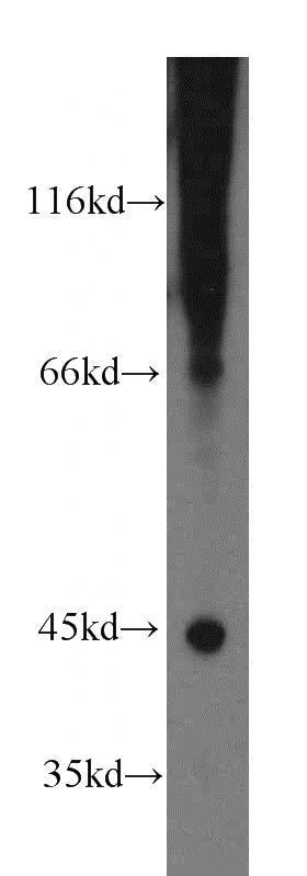 HEK-293 cells were subjected to SDS PAGE followed by western blot with Catalog No:110522(FANCL antibody) at dilution of 1:300