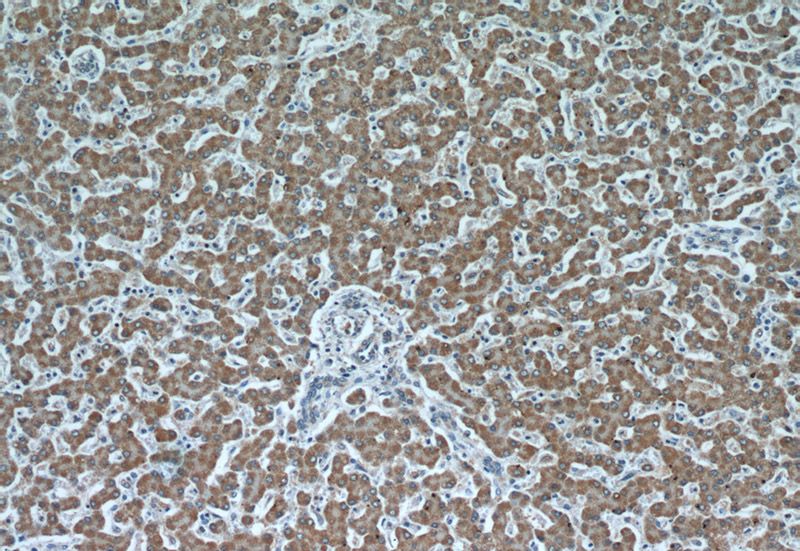 Immunohistochemical of paraffin-embedded human liver using Catalog No:107356(IVD antibody) at dilution of 1:50 (under 10x lens)