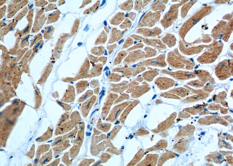 Immunohistochemistry of paraffin-embedded human heart tissue slide using Catalog No:107315(MYL3 Antibody) at dilution of 1:600 (under 40x lens).
