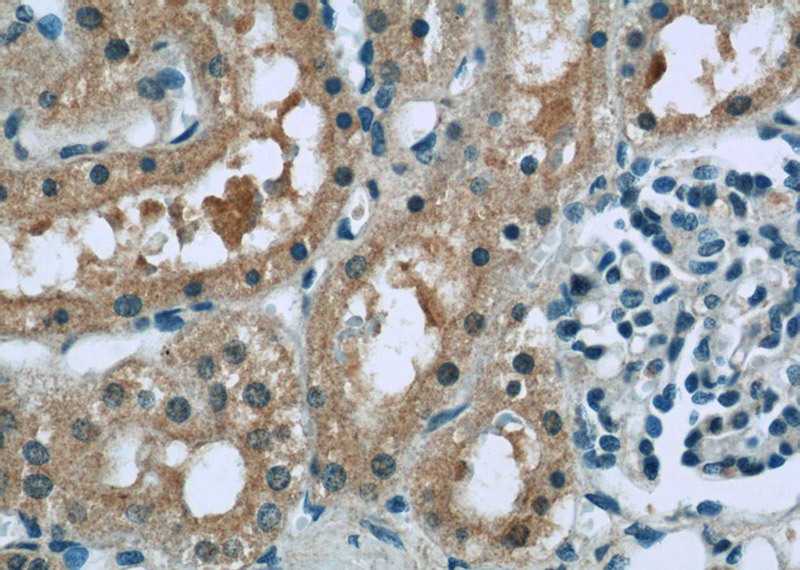 Immunohistochemistry of paraffin-embedded human kidney tissue slide using Catalog No:114845(RPS6KA3 Antibody) at dilution of 1:50(under 40x lens)