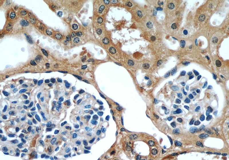 Immunohistochemical of paraffin-embedded human kidney using Catalog No:110906(GCLC antibody) at dilution of 1:50 (under 40x lens)