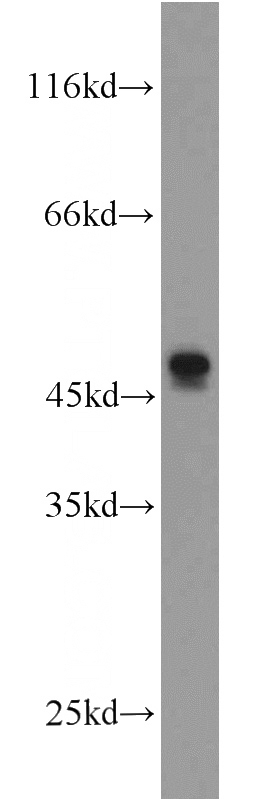 mouse small intestine tissue were subjected to SDS PAGE followed by western blot with Catalog No:112262(L2HGDH antibody) at dilution of 1:800