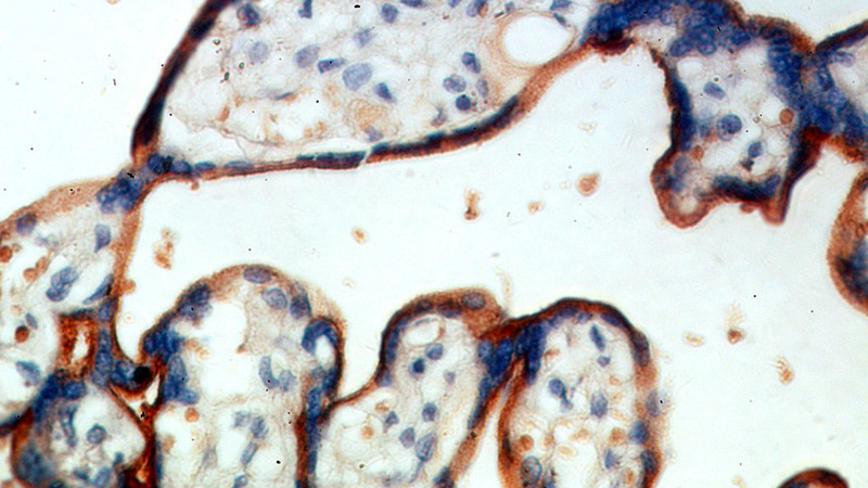 Immunohistochemical of paraffin-embedded human placenta using Catalog No:117062(SLC39A8 antibody) at dilution of 1:100 (under 40x lens)