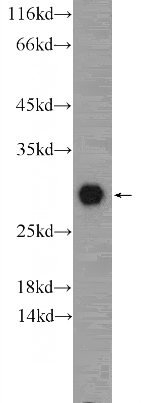 mouse brain tissue were subjected to SDS PAGE followed by western blot with Catalog No:108815(Calbindin Antibody) at dilution of 1:1000