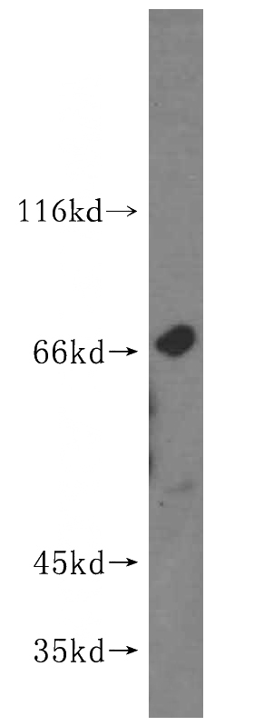 A431 cells were subjected to SDS PAGE followed by western blot with Catalog No:112098(KLHL21 antibody) at dilution of 1:400