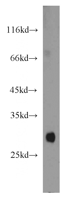 human blood tissue were subjected to SDS PAGE followed by western blot with Catalog No:108031(APOF antibody) at dilution of 1:1000