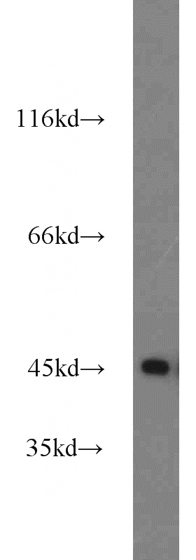 U-937 cells were subjected to SDS PAGE followed by western blot with Catalog No:113953(PLEK antibody) at dilution of 1:1000