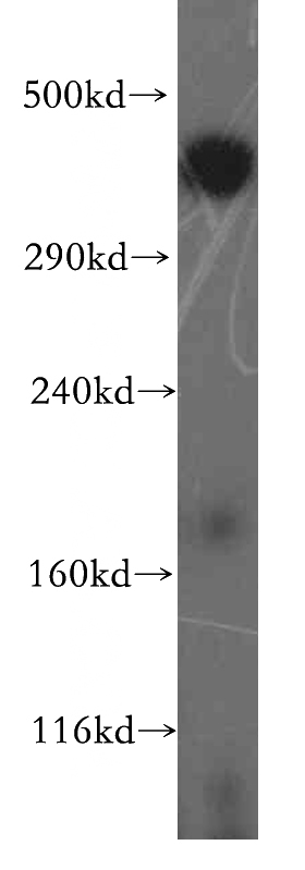 human brain tissue were subjected to SDS PAGE followed by western blot with Catalog No:117225(BRCA2 antibody) at dilution of 1:300