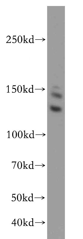 HeLa cells were subjected to SDS PAGE followed by western blot with Catalog No:109090(CDAN1 antibody) at dilution of 1:500