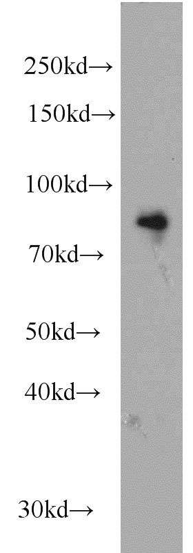 mouse brain tissue were subjected to SDS PAGE followed by western blot with Catalog No:117244(BRSK1 antibody) at dilution of 1:500