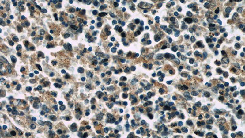 Immunohistochemistry of paraffin-embedded human spleen slide using Catalog No:107495(RAC2 Antibody) at dilution of 1:50