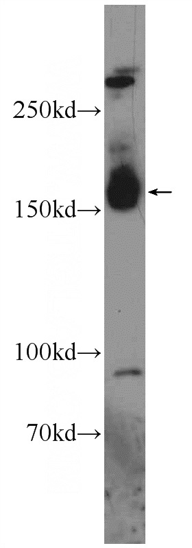 mouse brain tissue were subjected to SDS PAGE followed by western blot with Catalog No:111886(JMJD3 Antibody) at dilution of 1:600
