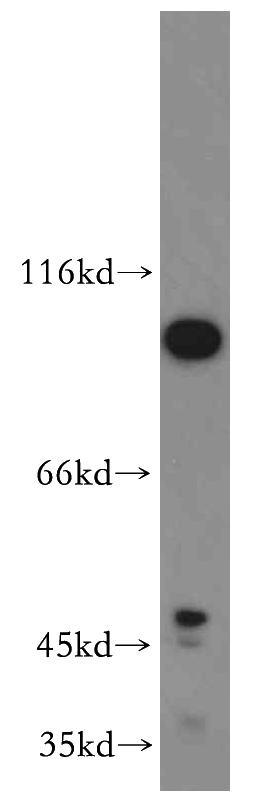 HEK-293 cells were subjected to SDS PAGE followed by western blot with Catalog No:115639(SPP antibody) at dilution of 1:300