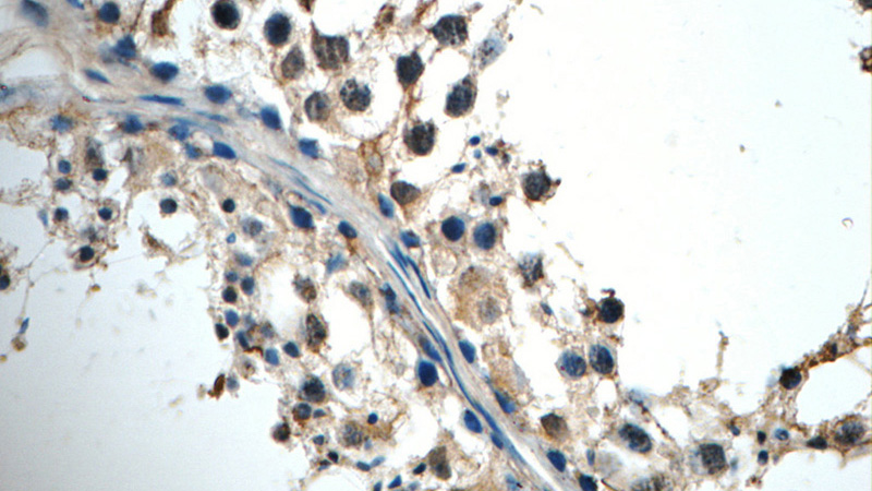 Immunohistochemistry of paraffin-embedded human testis tissue slide using Catalog No:109003(CCL27 Antibody) at dilution of 1:50 (under 40x lens)