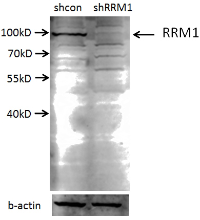 A549 cells (shcontrol and shRNA of RRM1) were subjected to SDS PAGE followed by western blot with Catalog No:114923 (RRM1 antibody) at dilution of 1:2000. (Data provided by Angran Biotech (www.miRNAlab.com)).
