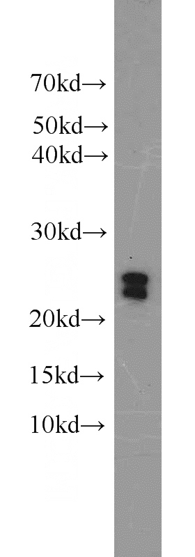 mouse liver tissue were subjected to SDS PAGE followed by western blot with Catalog No:108603(C16orf13 antibody) at dilution of 1:1000