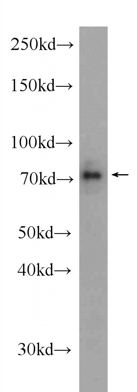 HEK-293 cells were subjected to SDS PAGE followed by western blot with Catalog No:110109(DNAJC21 Antibody) at dilution of 1:1000