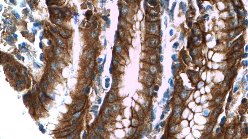 Immunohistochemistry of paraffin-embedded human stomach tissue slide using Catalog No:107576(CTNNA1 Antibody) at dilution of 1:200 (under 40x lens)