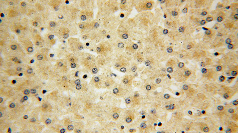 Immunohistochemical of paraffin-embedded human liver using Catalog No:116550(UFC1 antibody) at dilution of 1:100 (under 40x lens)