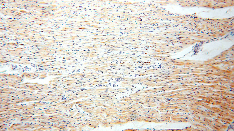 Immunohistochemical of paraffin-embedded human heart using Catalog No:113363(NUDT8 antibody) at dilution of 1:100 (under 10x lens)