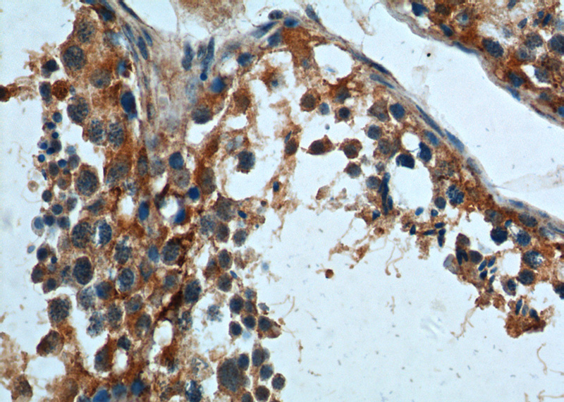 Immunohistochemistry of paraffin-embedded human testis tissue slide using Catalog No:116237(TRAIP Antibody) at dilution of 1:200 (under 40x lens).