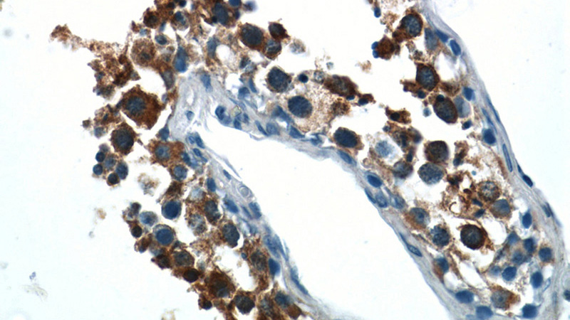 Immunohistochemistry of paraffin-embedded human testis tissue slide using Catalog No:112419(LZTFL1 Antibody) at dilution of 1:50 (under 40x lens)