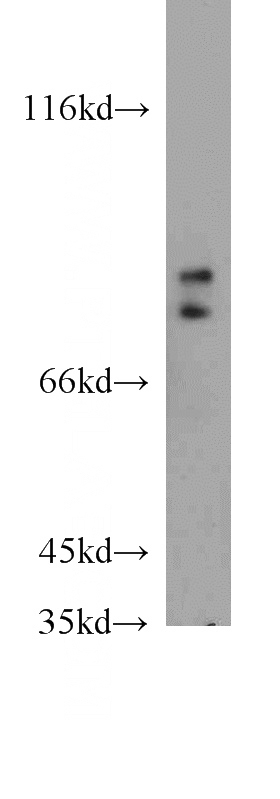 HEK-293 cells were subjected to SDS PAGE followed by western blot with Catalog No:110709(FOXP2 antibody) at dilution of 1:300