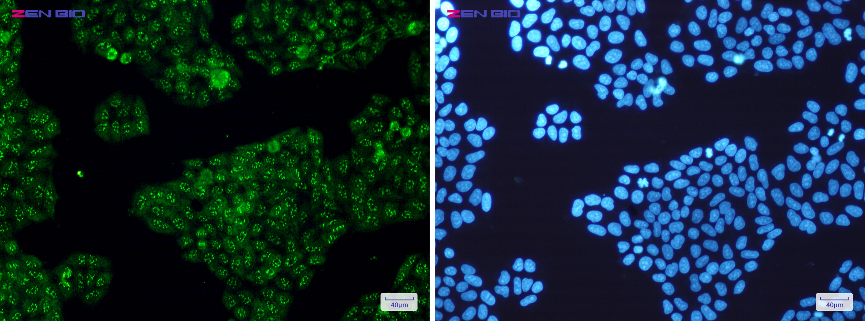 Immunocytochemistry of Calretinin(green) in Hela cells using Calretinin Rabbit mAb at dilution 1/50, and DAPI(blue)