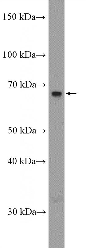 rat kidney tissue were subjected to SDS PAGE followed by western blot with Catalog No:115346(SLC5A8 Antibody) at dilution of 1:1000