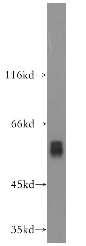 U-937 cells were subjected to SDS PAGE followed by western blot with Catalog No:114083(PPARA antibody) at dilution of 1:100
