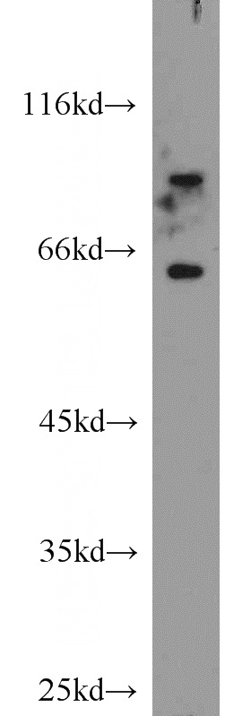 SH-SY5Y cells were subjected to SDS PAGE followed by western blot with Catalog No:115857(TAU antibody) at dilution of 1:1000