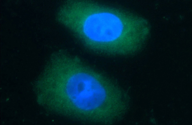 Immunofluorescent analysis of HeLa cells using Catalog No:111970(KCNJ3 Antibody) at dilution of 1:25 and Rhodamine-Goat anti-Rabbit IgG