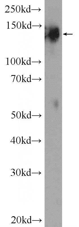 mouse brain tissue were subjected to SDS PAGE followed by western blot with Catalog No:115784(SYNJ1 Antibody) at dilution of 1:4000