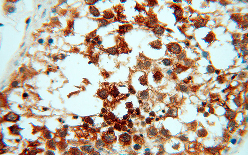 Immunohistochemical of paraffin-embedded human testis using Catalog No:114940(RUVBL2 antibody) at dilution of 1:50 (under 40x lens)