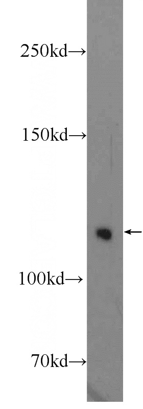mouse brain tissue were subjected to SDS PAGE followed by western blot with Catalog No:116488(TUBGCP5 Antibody) at dilution of 1:300