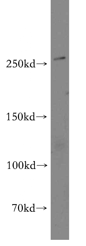 mouse brain tissue were subjected to SDS PAGE followed by western blot with Catalog No:108757(CACNA1B antibody) at dilution of 1:300