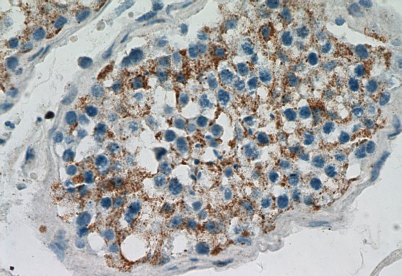 Immunohistochemical of paraffin-embedded human testis using Catalog No:108559(BZW1 antibody) at dilution of 1:100 (under 40x lens)