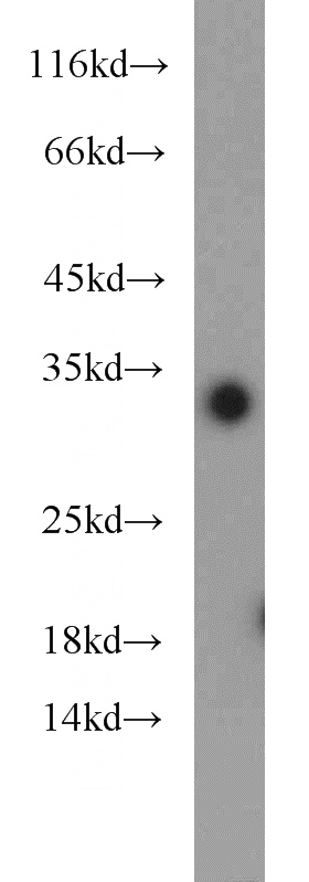 Jurkat cells were subjected to SDS PAGE followed by western blot with Catalog No:111797(ING5 antibody) at dilution of 1:1000