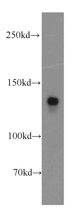 mouse brain tissue were subjected to SDS PAGE followed by western blot with Catalog No:112303(LPHN3 antibody) at dilution of 1:300