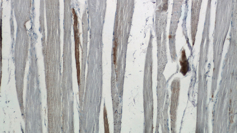 Immunohistochemistry of paraffin-embedded human skeletal muscle tissue slide using Catalog No:114606(RBM24 Antibody) at dilution of 1:50 (under 10x lens)